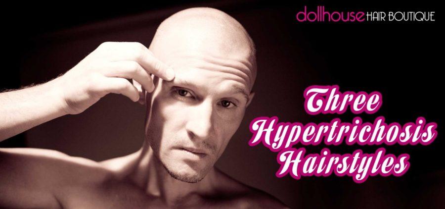 Three hypertrichosis hairstyles
